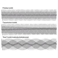 Musiikin intervalleja eri viritysjrjestelmiss (kyrnpiirtoa)